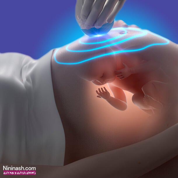 علائم و نشانه های بارداری پسر در سه ماه اول