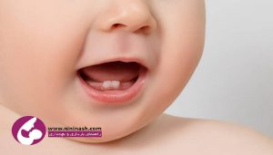 اولین دندان نوزاد نی نی ناش