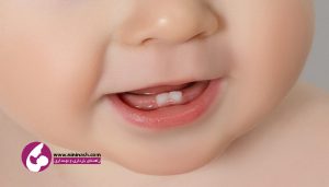 دندان نوزاد نی نی ناش
