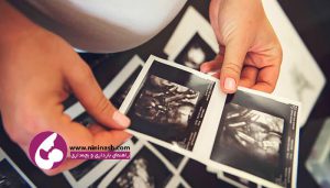 سونوگرافی های دوران بارداری